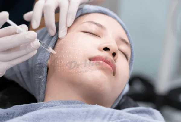 Các loại mesotherapy và một số chú ý khi sử dụng