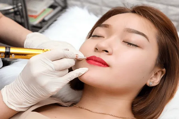 Giải đáp nên phun môi trước hay tiêm filler trước?