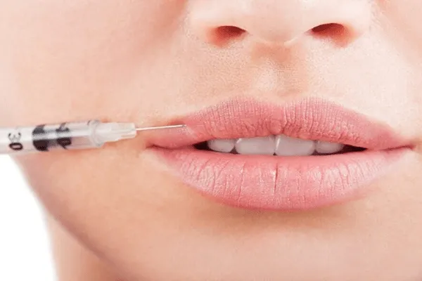 Giải đáp nên phun môi trước hay tiêm filler trước?