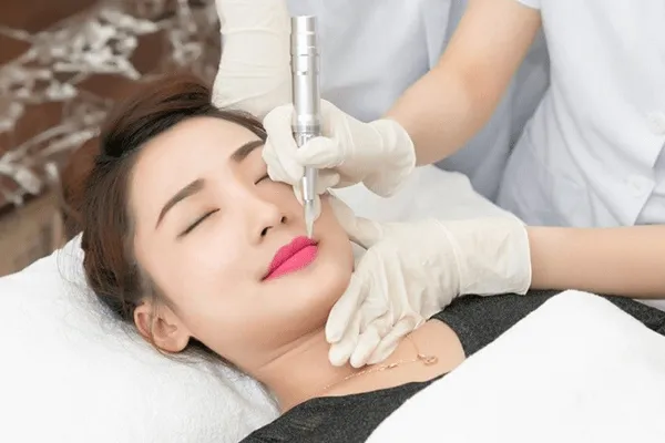 Giải đáp nên phun môi trước hay tiêm filler trước?