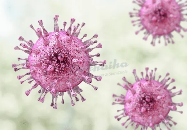 Herpes môi tái phát nhiều lần do đâu. Bác sĩ chuyên khoa chia sẻ