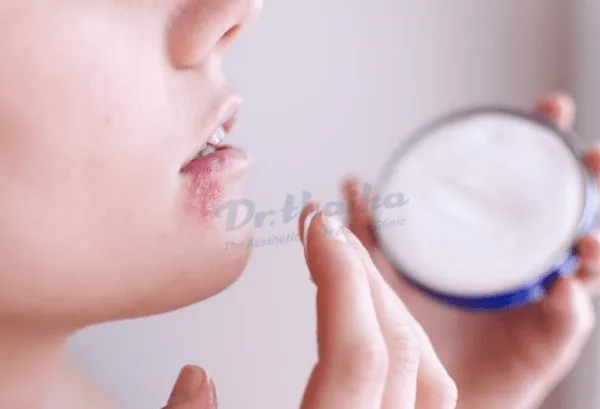 Herpes môi tái phát nhiều lần do đâu. Bác sĩ chuyên khoa chia sẻ