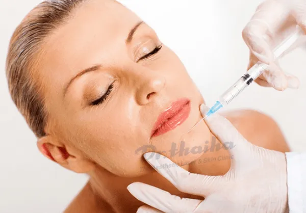 Hướng dẫn kỹ thuật tiêm filler chuẩn y khoa