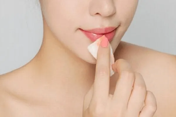 Phương pháp tiêm filler môi giữ được bao lâu?