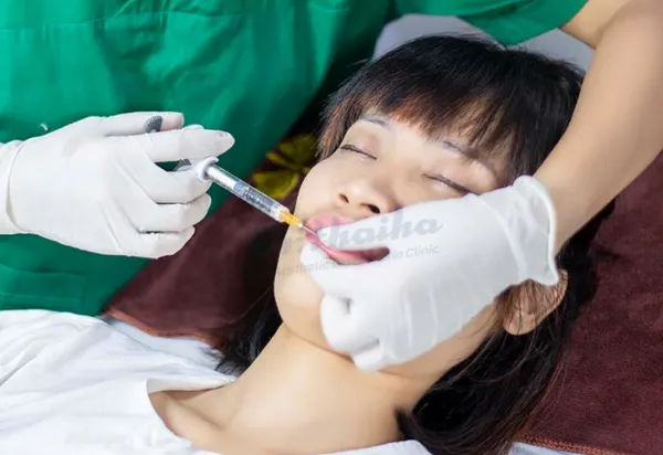 Tiêm 2 loại filler khác nhau có được không? 