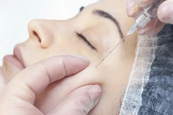 Tiêm filler hốc mắt được thực hiện như thế nào?