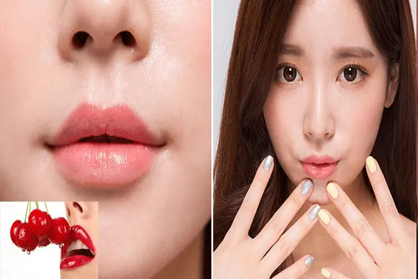 Tiêm filler môi cherry có khiến môi bị đơ cứng, mất tự nhiên không?