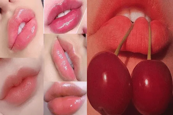 Tiêm filler môi cherry có khiến môi bị đơ cứng, mất tự nhiên không?