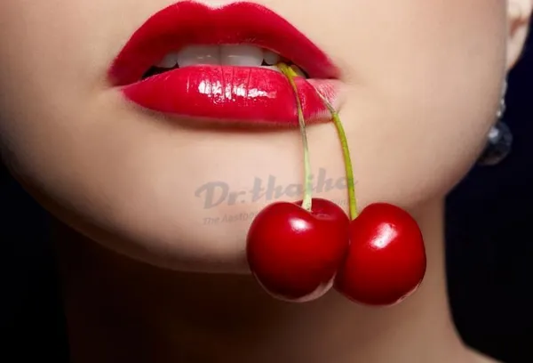 Tiêm filler môi cherry là tiêm gì? Có ảnh hưởng đến da không