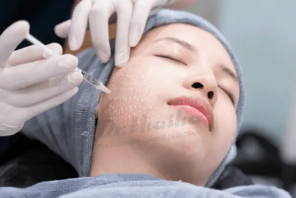 Tiêm mesotherapy là gì? Có vai trò gì trong thẩm mỹ da liễu?