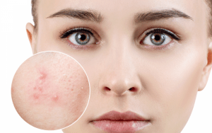 Sự khác biệt giữa da mặt và da toàn thân có thể bạn chưa biết?