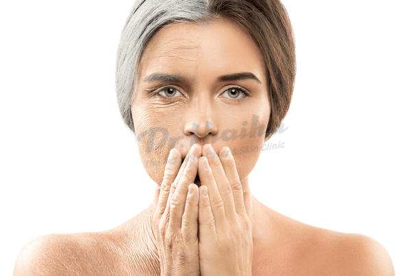 Có nên căng da mặt bằng chỉ collagen? Chuyên gia giải thích