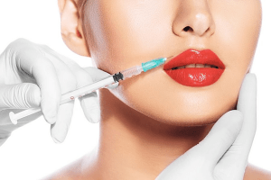 Nguyên nhân tiêm filler môi bị lệch và cách khắc phục hiệu quả