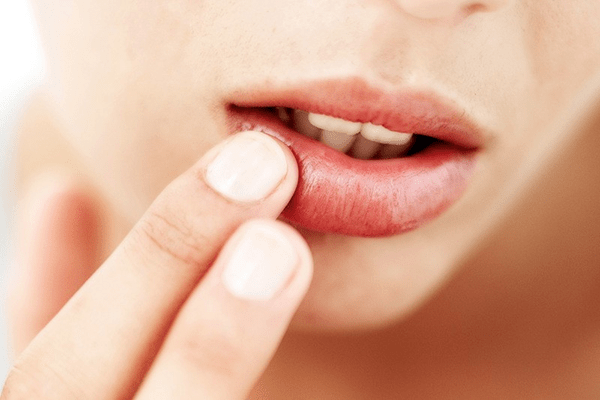 Sau khi tiêm filler môi có hôn được không? Ảnh hưởng như thế nào?