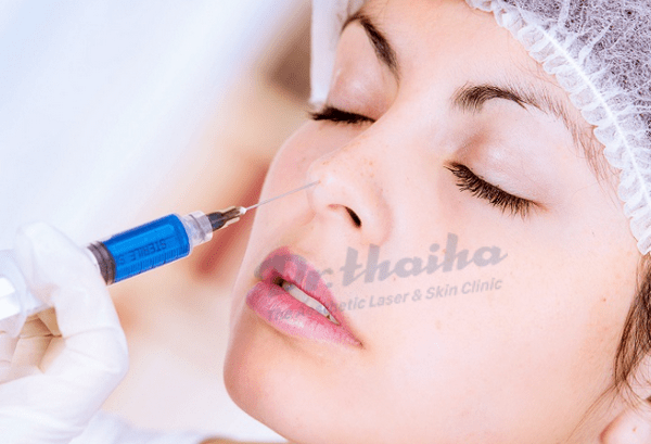 Tiêm botox mũi: Những điều chị em cần nên biết trước khi tiêm