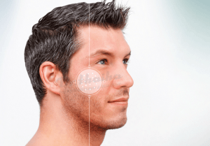 Cách làm căng da mặt cho nam giới hiệu quả nhất